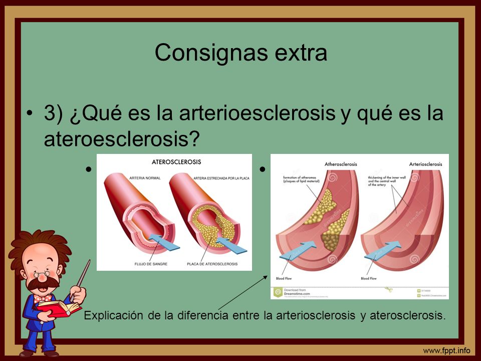 Consignas extra 3) ¿Qué es la arterioesclerosis y qué es la ateroesclerosis • •
