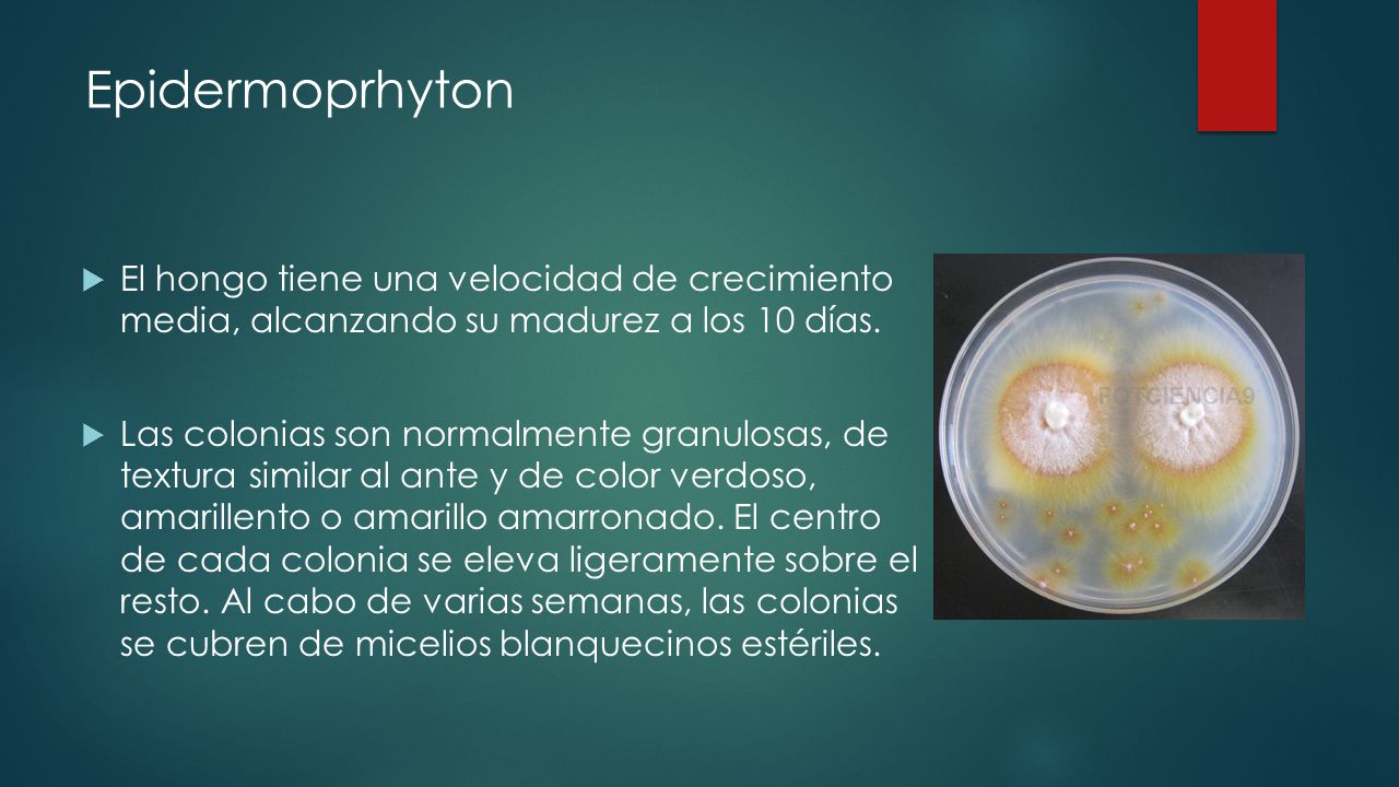 Epidermoprhyton El hongo tiene una velocidad de crecimiento media, alcanzando su madurez a los 10 días.
