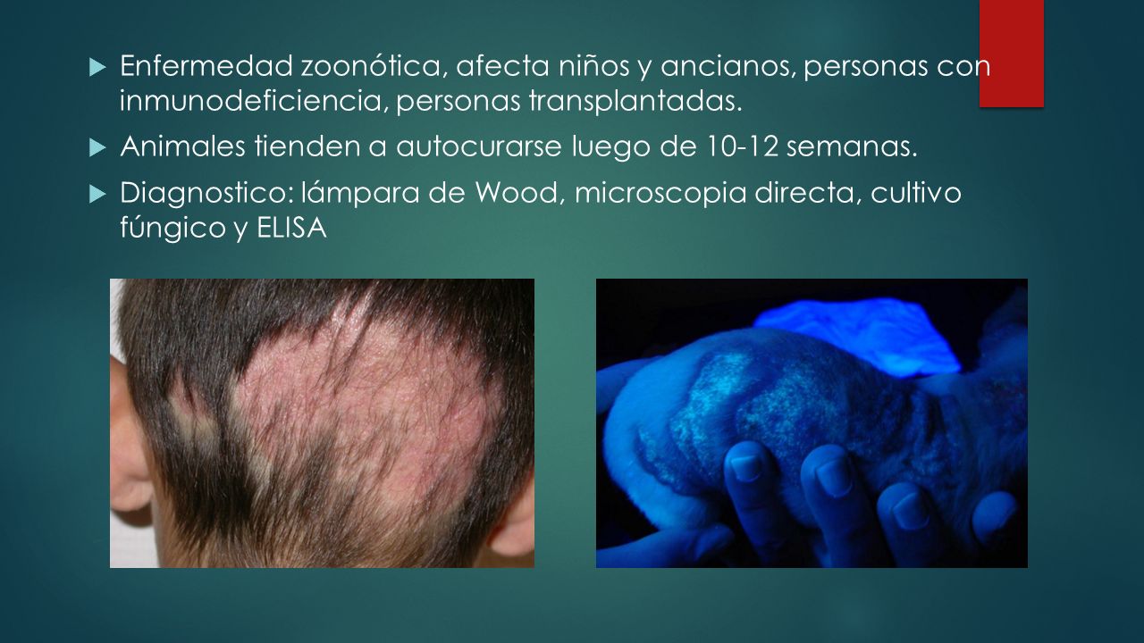 Enfermedad zoonótica, afecta niños y ancianos, personas con inmunodeficiencia, personas transplantadas.
