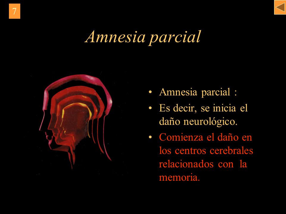 Amnesia parcial Amnesia parcial :