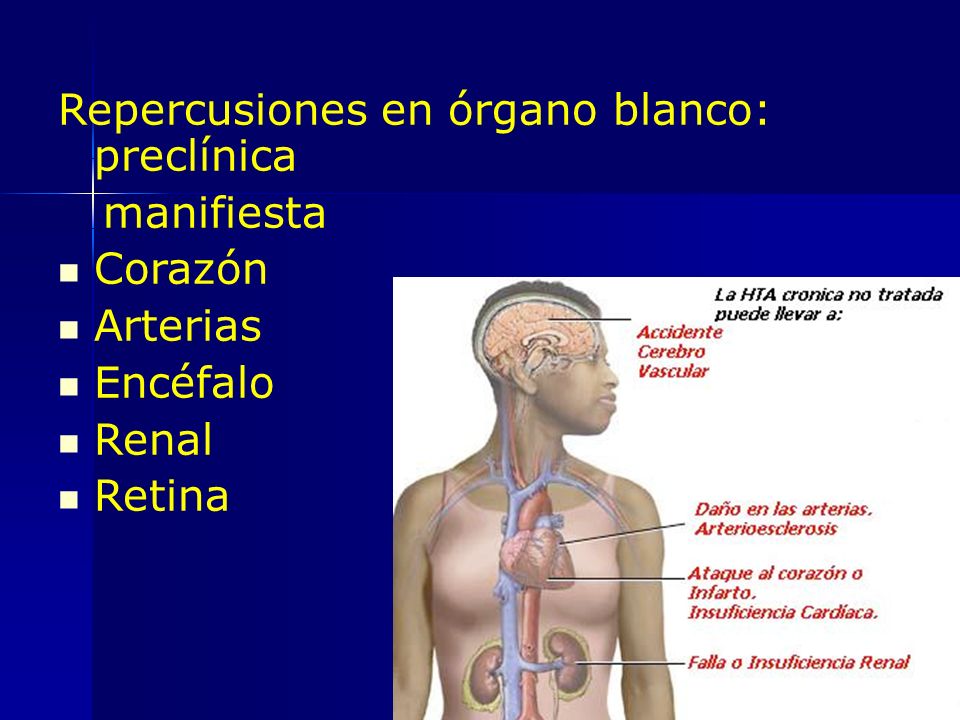 Repercusiones en órgano blanco: preclínica manifiesta Corazón Arterias