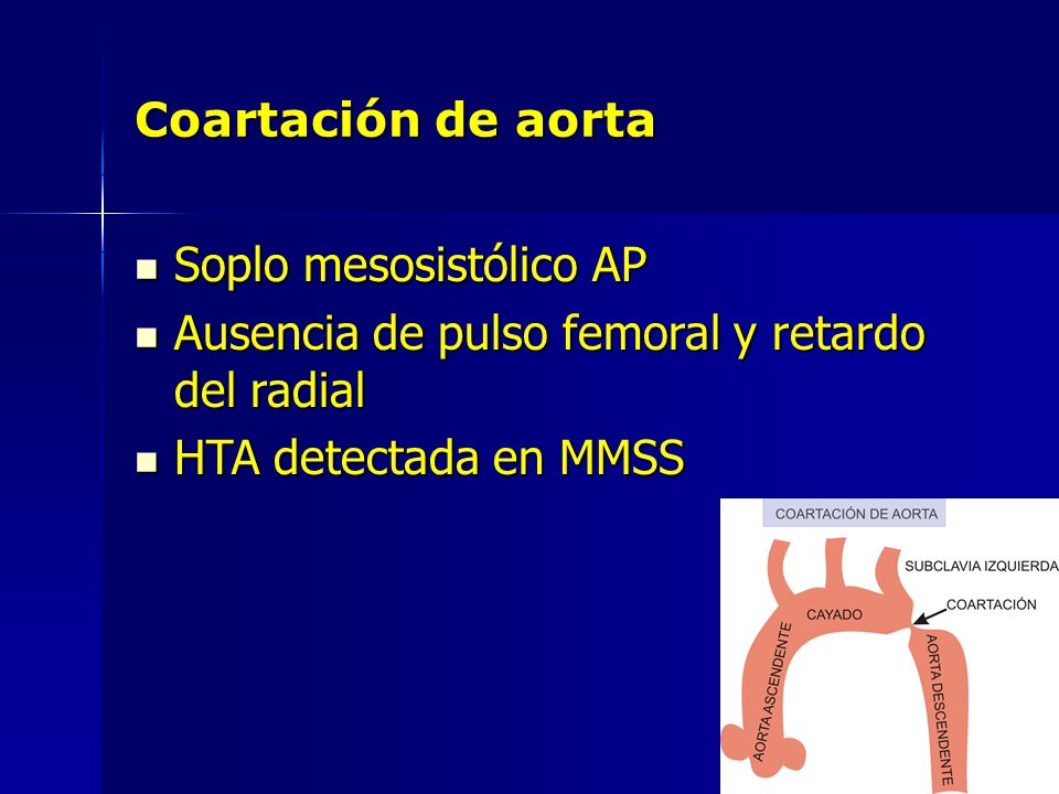Soplo mesosistólico AP Ausencia de pulso femoral y retardo del radial