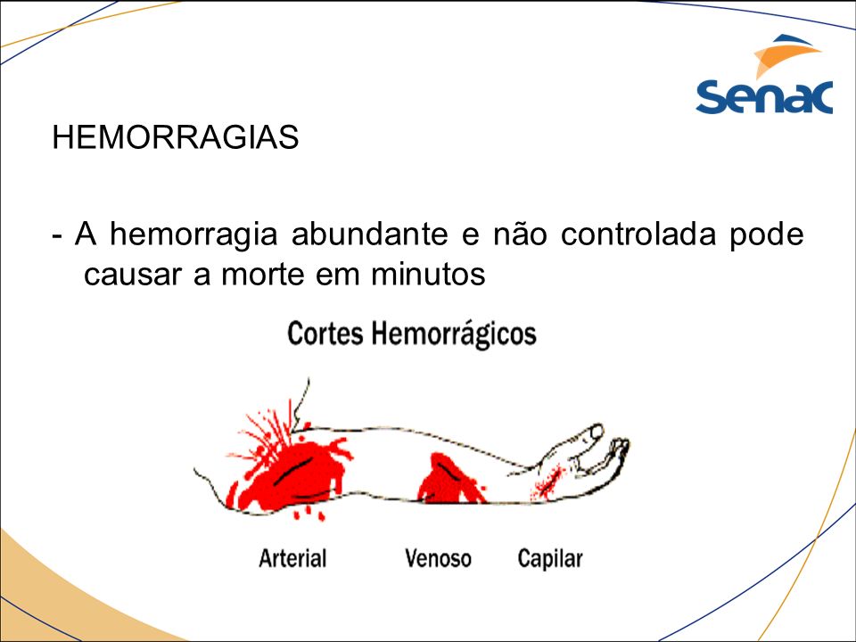 HEMORRAGIAS - A hemorragia abundante e não controlada pode causar a morte em minutos