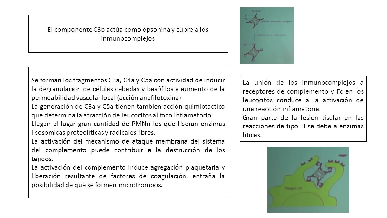 El componente C3b actúa como opsonina y cubre a los inmunocomplejos