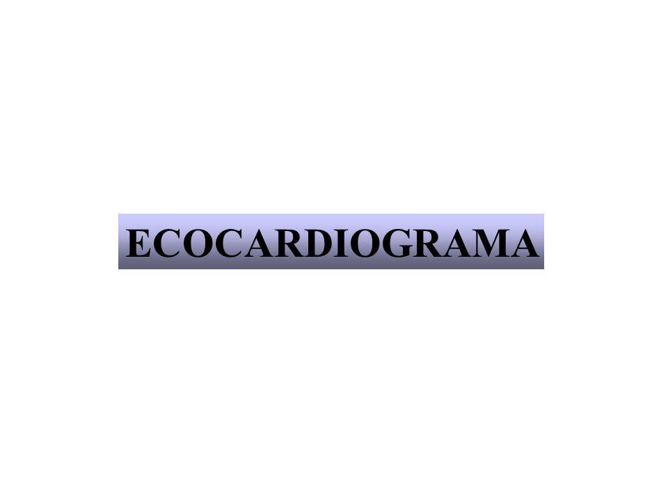 ECOCARDIOGRAMA