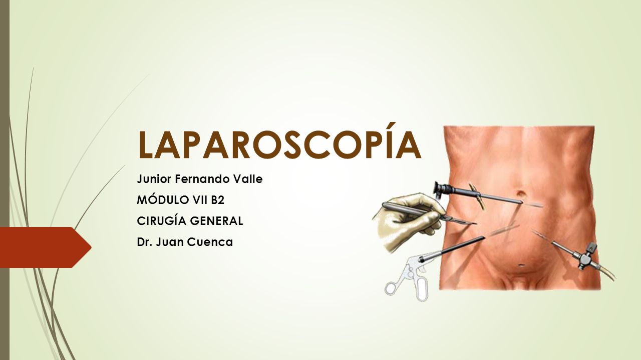Junior Fernando Valle MÓDULO VII B2 CIRUGÍA GENERAL Dr. Juan Cuenca