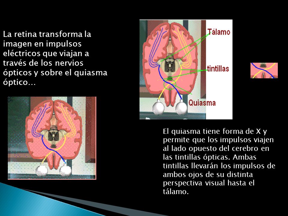 La retina transforma la imagen en impulsos eléctricos que viajan a través de los nervios ópticos y sobre el quiasma óptico…