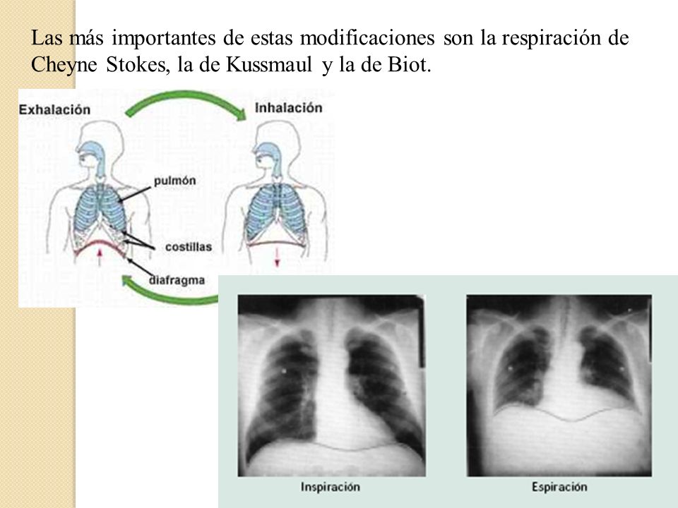 Las más importantes de estas modificaciones son la respiración de Cheyne Stokes, la de Kussmaul y la de Biot.