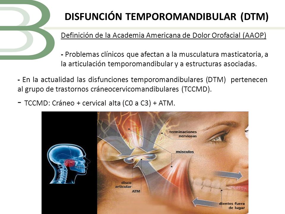 TCCMD: Cráneo + cervical alta (C0 a C3) + ATM.