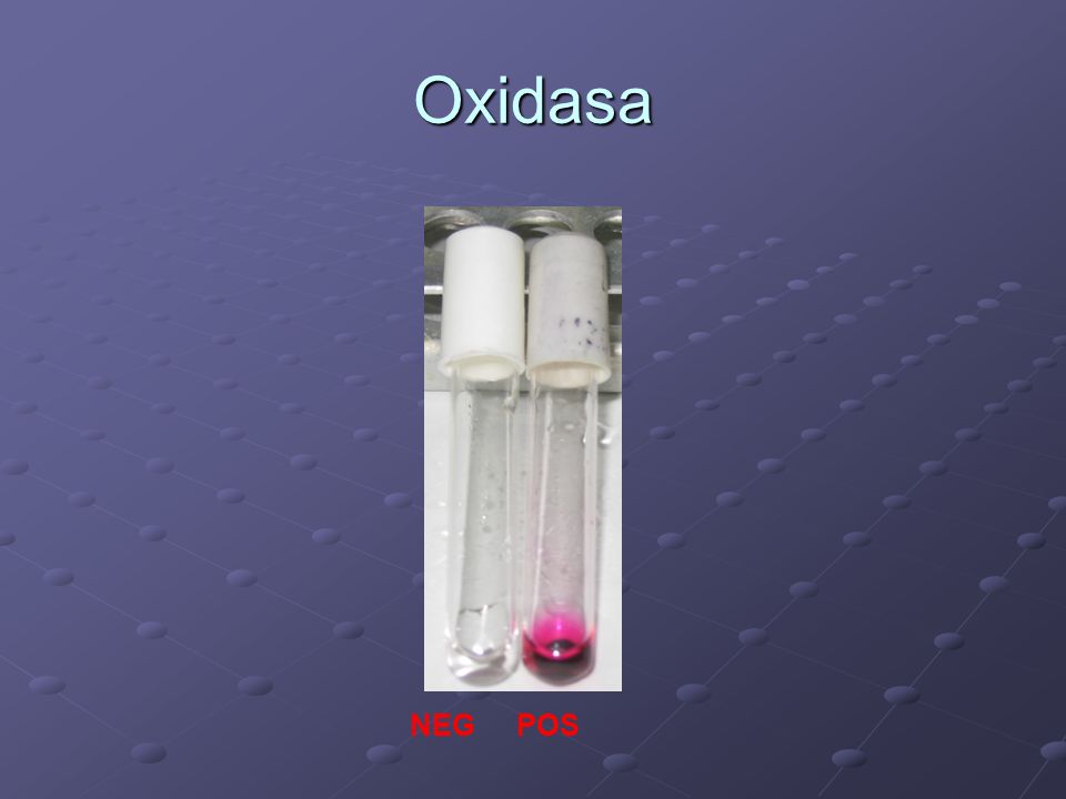 Oxidasa NEG POS