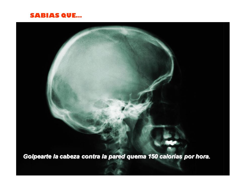 Golpearte la cabeza contra la pared quema 150 calorías por hora.