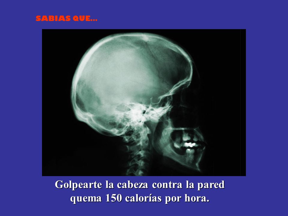 Golpearte la cabeza contra la pared quema 150 calorías por hora.