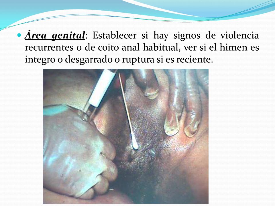 Área genital: Establecer si hay signos de violencia recurrentes o de coito anal habitual, ver si el himen es integro o desgarrado o ruptura si es reciente.