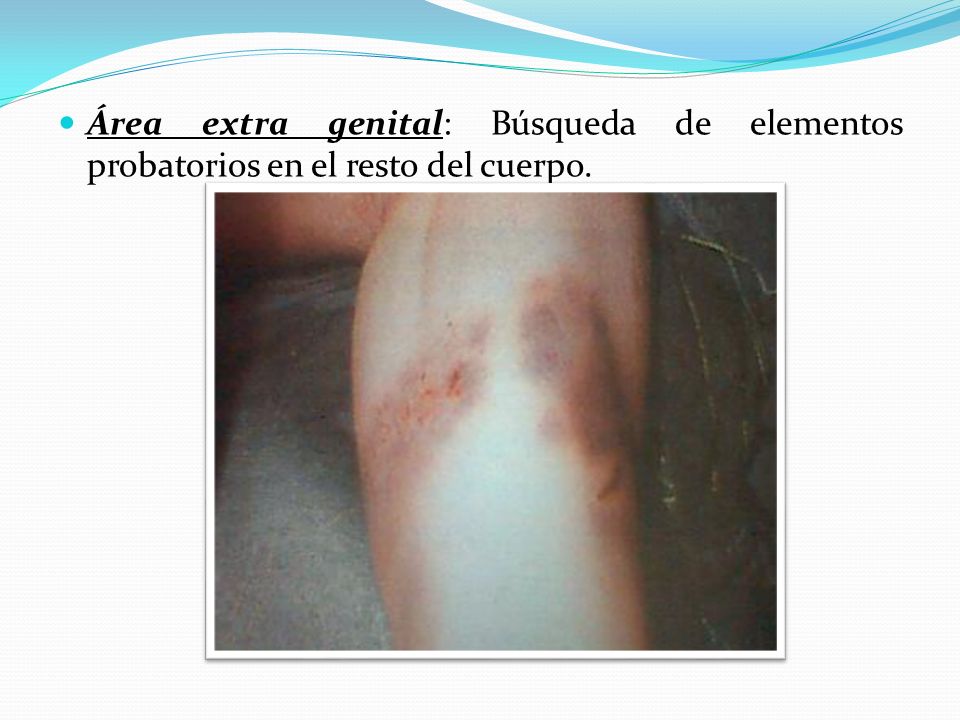 Área extra genital: Búsqueda de elementos probatorios en el resto del cuerpo.