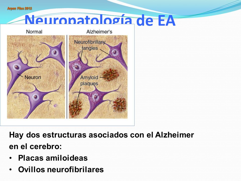 Neuropatología de EA Hay dos estructuras asociados con el Alzheimer