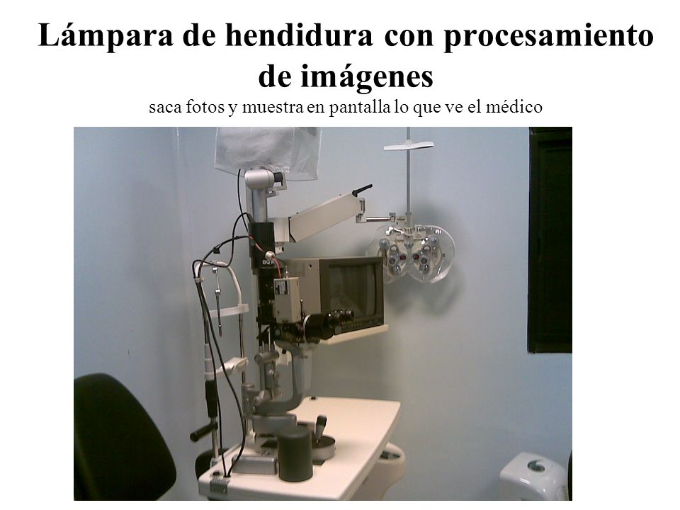 Lámpara de hendidura con procesamiento de imágenes saca fotos y muestra en pantalla lo que ve el médico