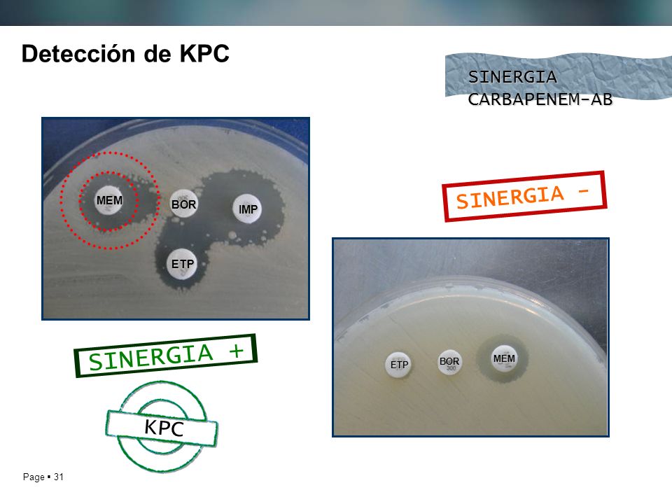 SINERGIA + Detección de KPC SINERGIA - KPC SINERGIA CARBAPENEM-AB MEM