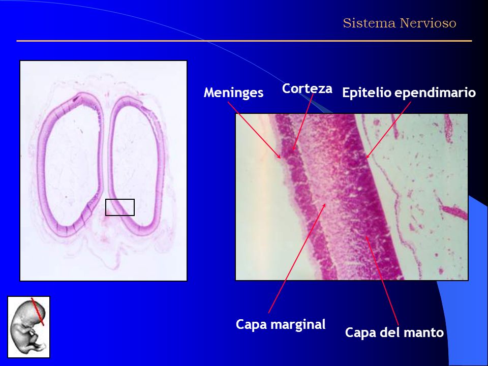 Corteza Meninges Epitelio ependimario Capa marginal Capa del manto