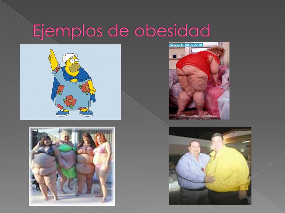 Ejemplos de obesidad