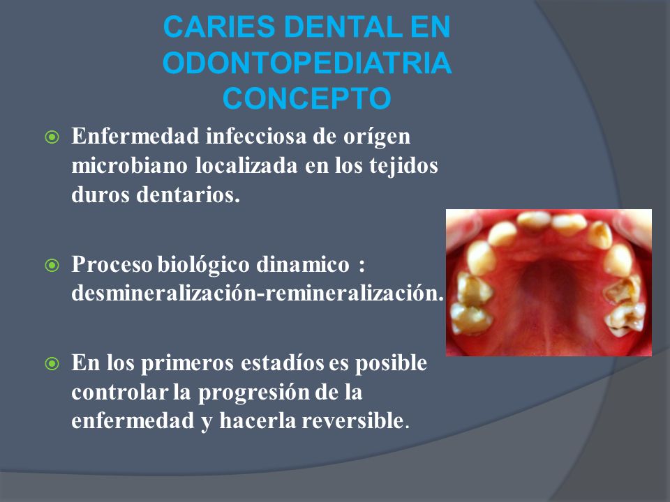 CARIES DENTAL EN ODONTOPEDIATRIA CONCEPTO