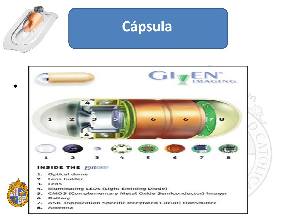 Cápsula Video cápsula endoscópica (VCE): método diagnóstico no invasivo para el estudio del intestino delgado.