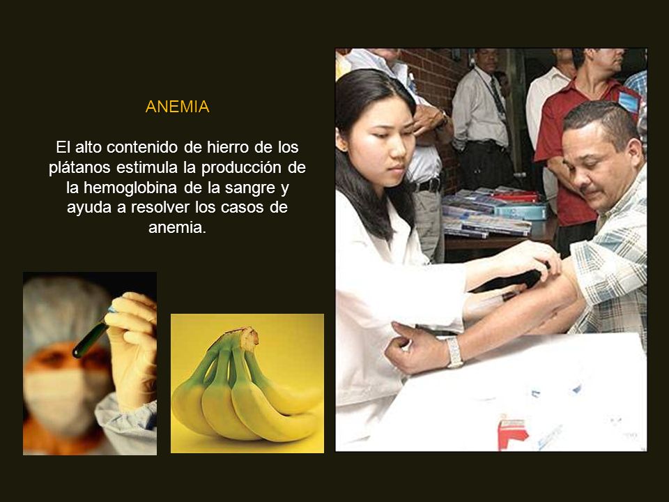 ANEMIA El alto contenido de hierro de los plátanos estimula la producción de la hemoglobina de la sangre y ayuda a resolver los casos de anemia.