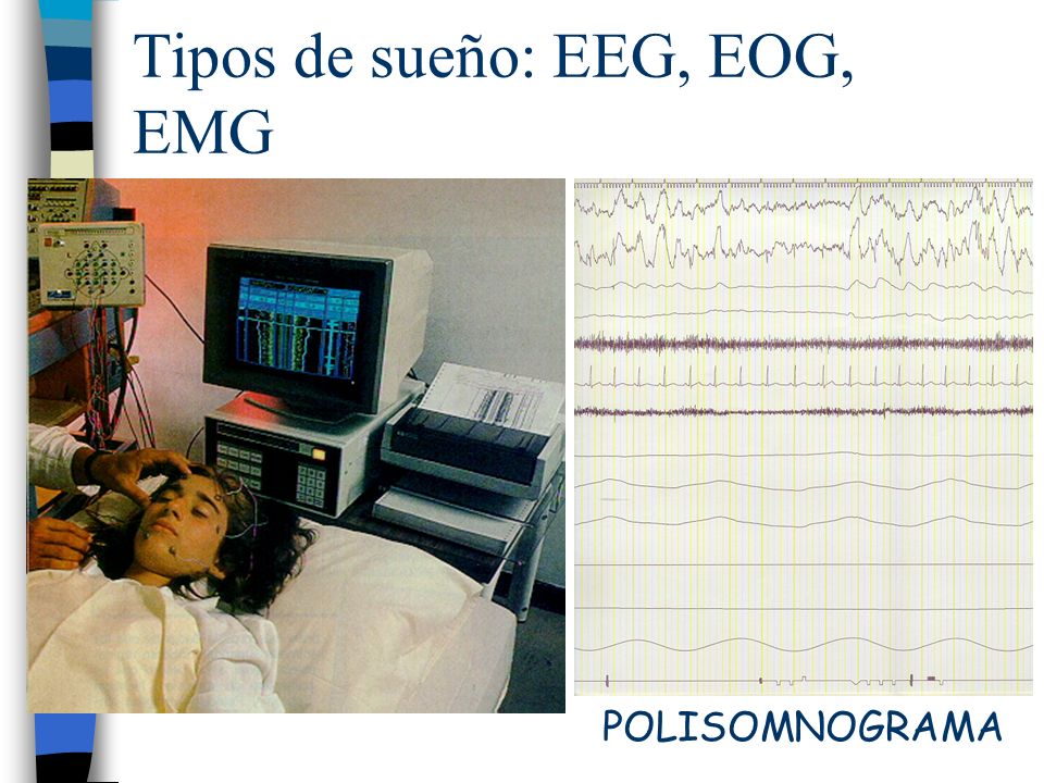 Tipos de sueño: EEG, EOG, EMG