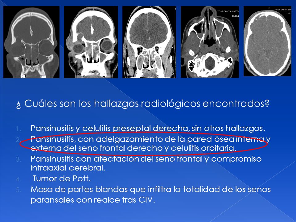¿ Cuáles son los hallazgos radiológicos encontrados