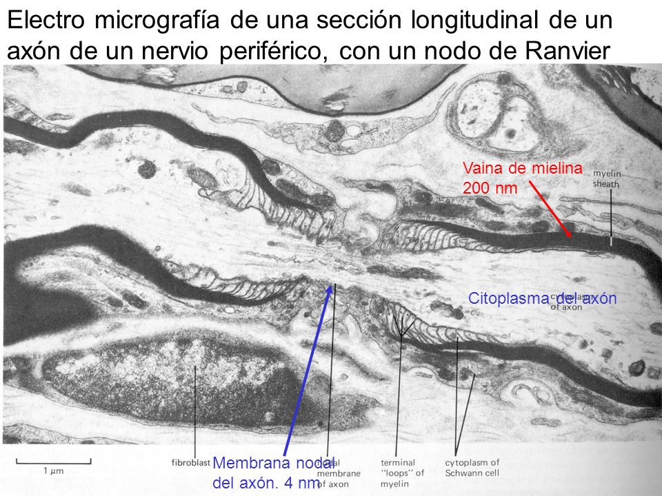 Electro micrografía de una sección longitudinal de un axón de un nervio periférico, con un nodo de Ranvier