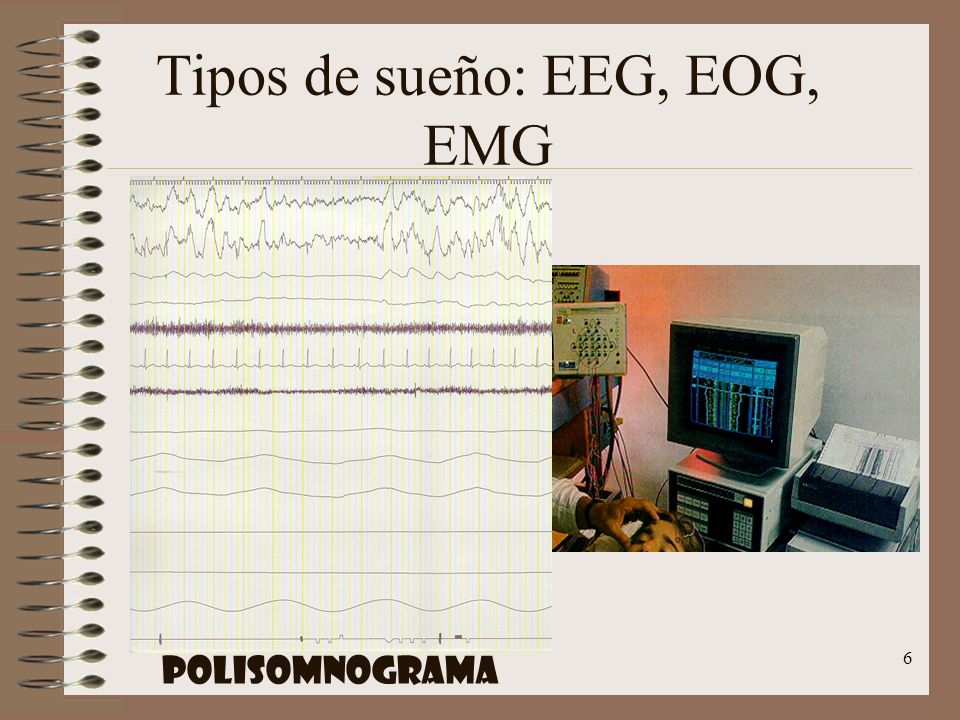 Tipos de sueño: EEG, EOG, EMG