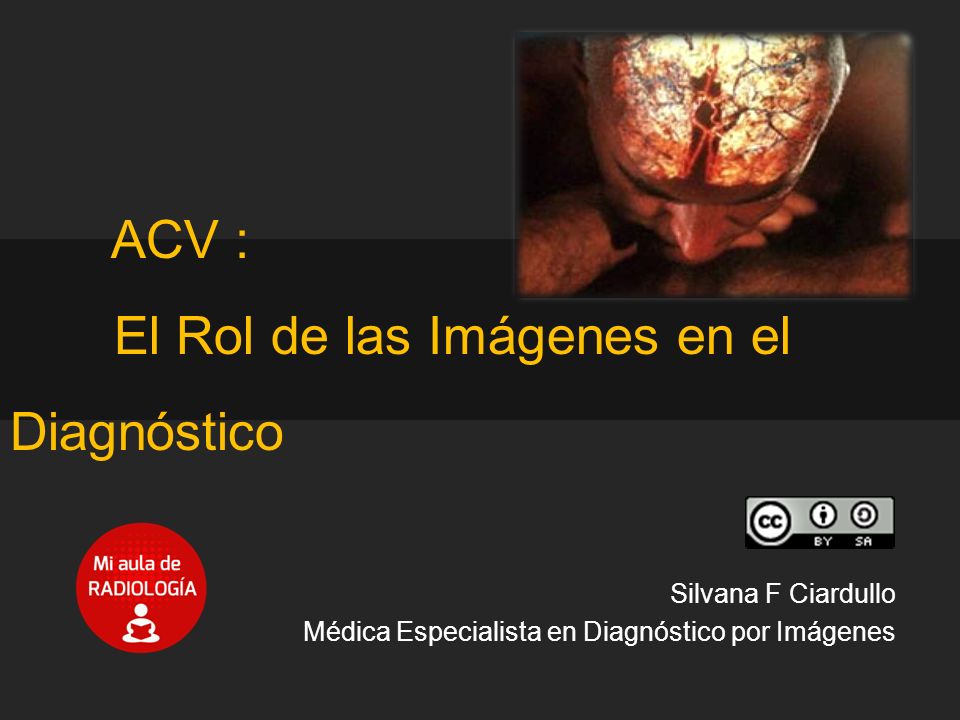 ACV : El Rol de las Imágenes en el Diagnóstico