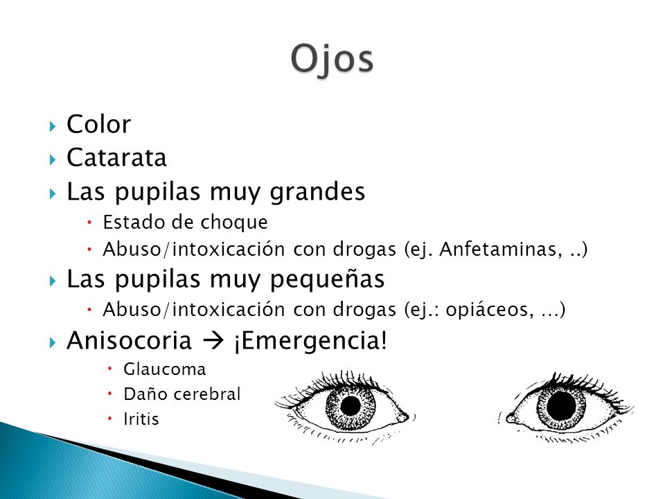 Ojos Color Catarata Las pupilas muy grandes Las pupilas muy pequeñas