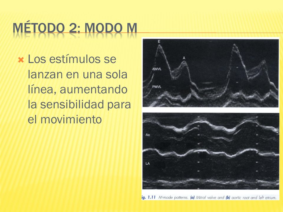 Método 2: Modo M Los estímulos se lanzan en una sola línea, aumentando la sensibilidad para el movimiento.