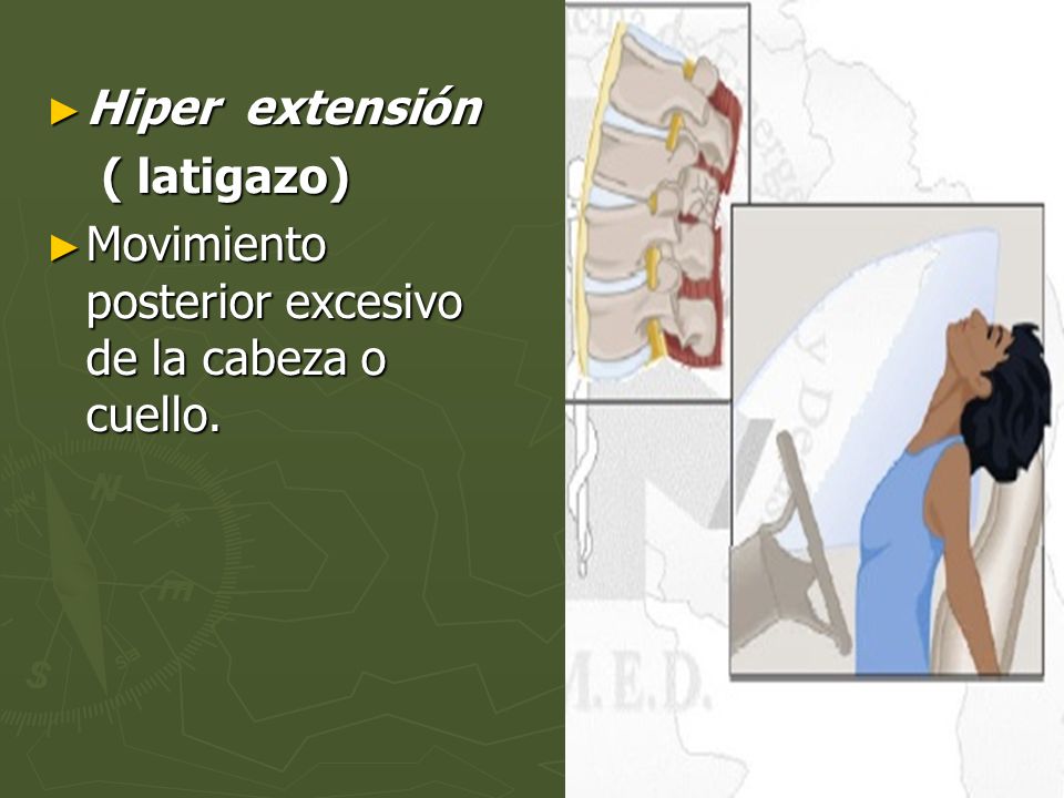 Hiper extensión ( latigazo) Movimiento posterior excesivo de la cabeza o cuello.