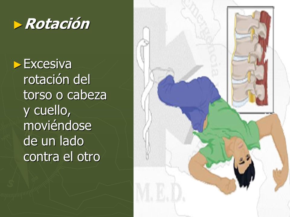 Rotación Excesiva rotación del torso o cabeza y cuello, moviéndose de un lado contra el otro