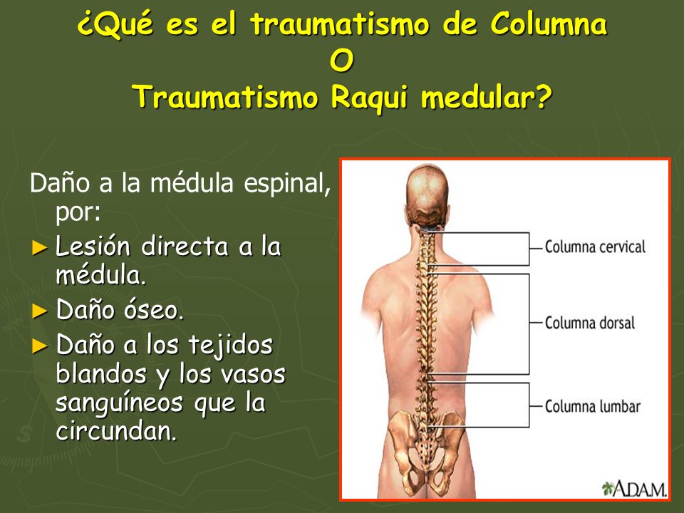 ¿Qué es el traumatismo de Columna O Traumatismo Raqui medular
