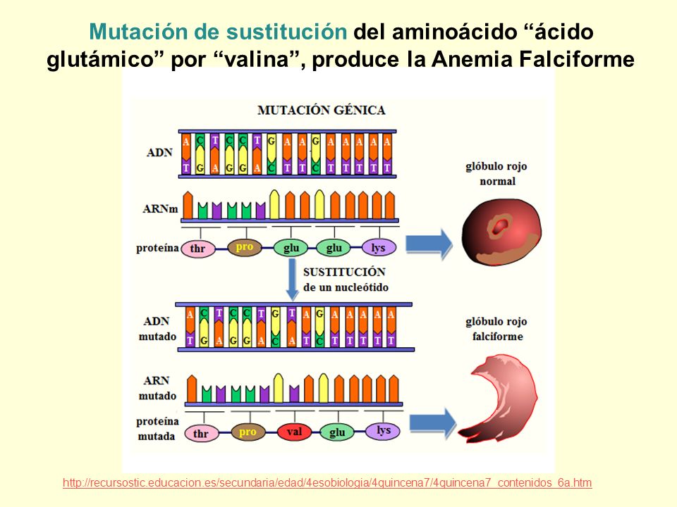 Mutación de sustitución del aminoácido ácido glutámico por valina , produce la Anemia Falciforme