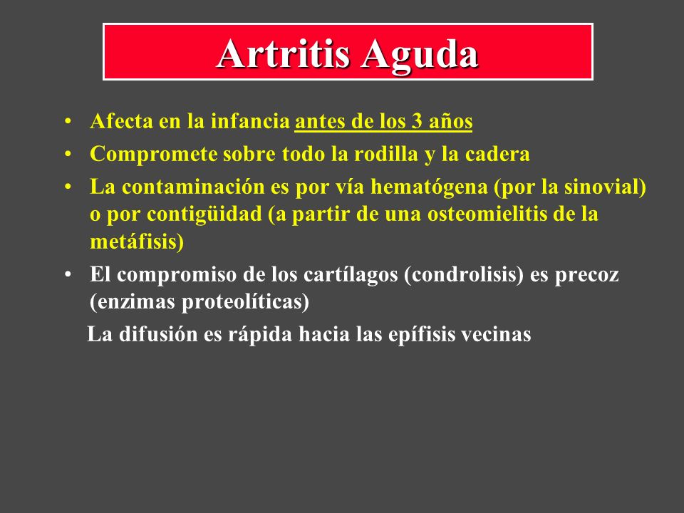 Artritis Aguda Afecta en la infancia antes de los 3 años