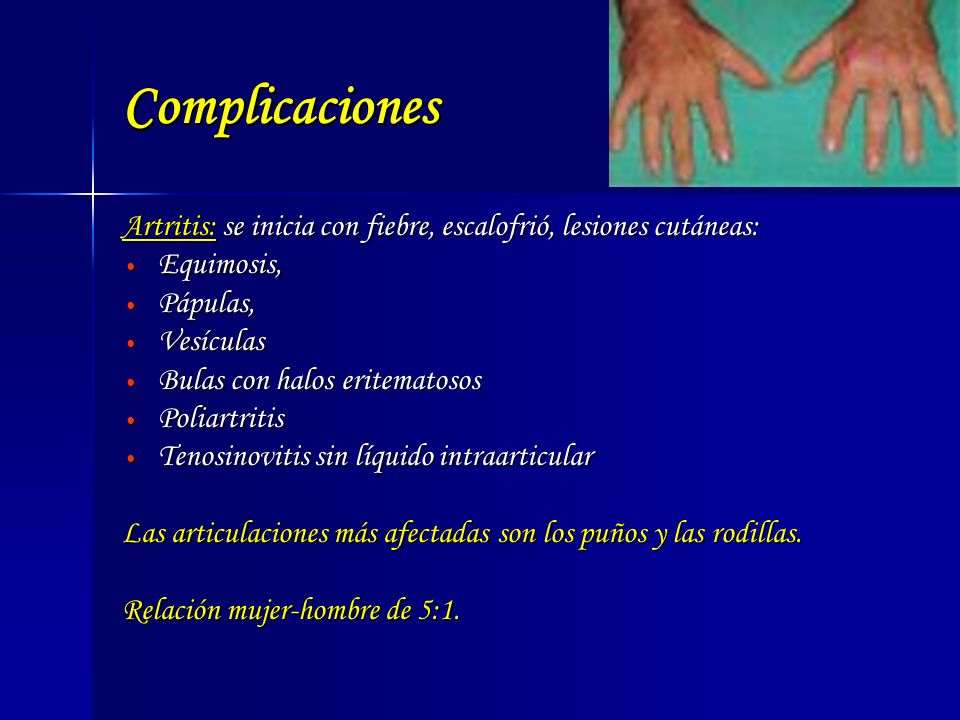 Complicaciones Artritis: se inicia con fiebre, escalofrió, lesiones cutáneas: Equimosis, Pápulas,