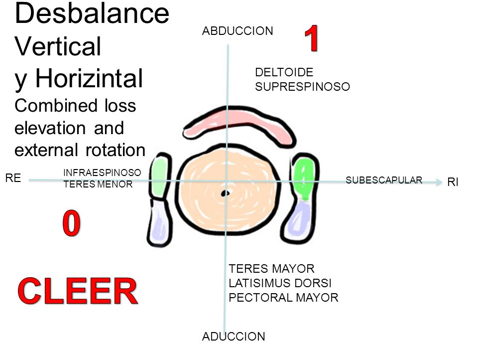 1 ABDUCCION. Desbalance Vertical y Horizintal Combined loss elevation and external rotation. DELTOIDE.