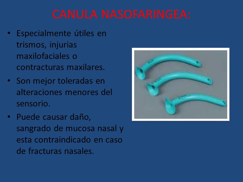 CANULA NASOFARINGEA: Especialmente útiles en trismos, injurias maxilofaciales o contracturas maxilares.