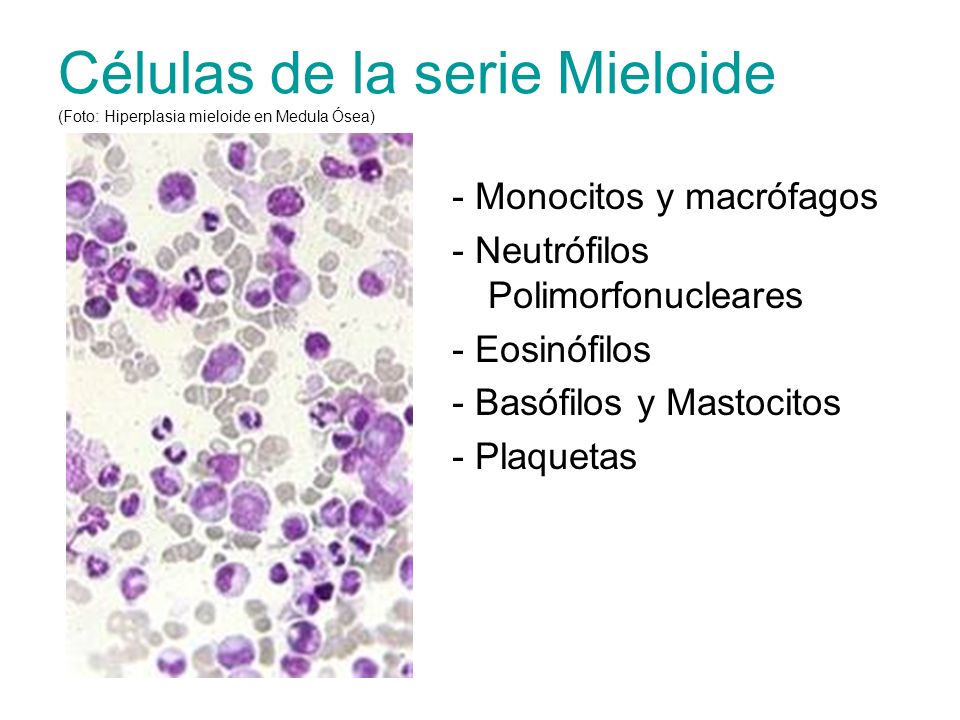 Células de la serie Mieloide (Foto: Hiperplasia mieloide en Medula Ósea)