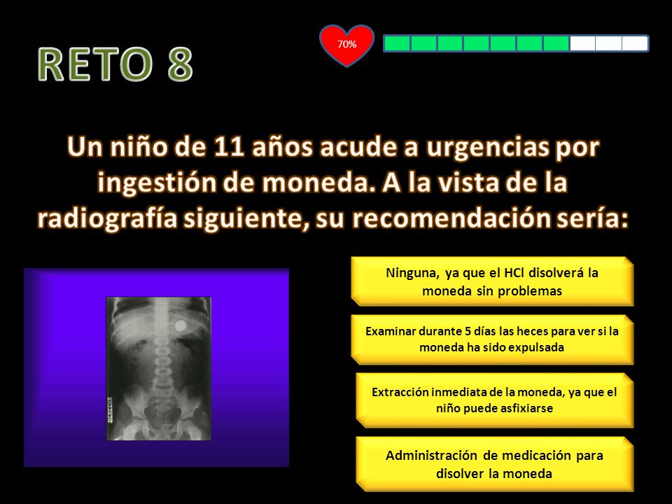 70% RETO 8. Un niño de 11 años acude a urgencias por ingestión de moneda. A la vista de la radiografía siguiente, su recomendación sería: