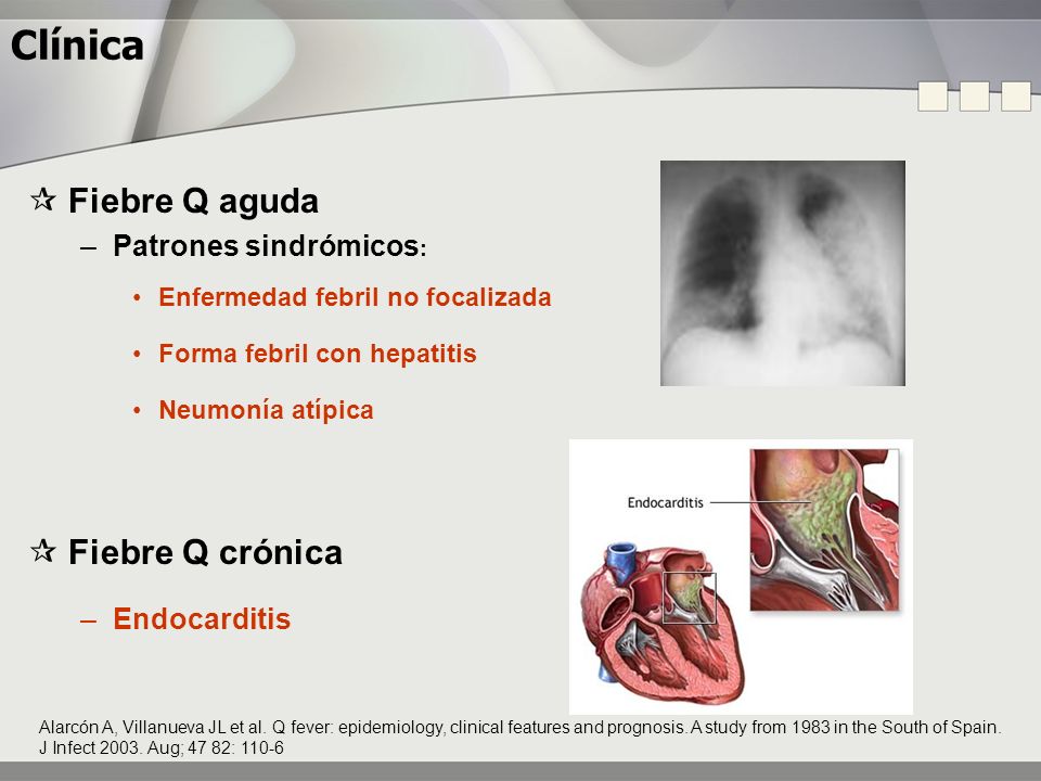 Clínica  Fiebre Q aguda  Fiebre Q crónica Patrones sindrómicos: