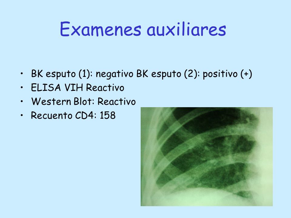 Examenes auxiliares BK esputo (1): negativo BK esputo (2): positivo (+) ELISA VIH Reactivo. Western Blot: Reactivo.