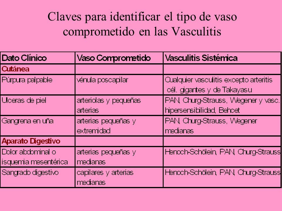 Claves para identificar el tipo de vaso comprometido en las Vasculitis
