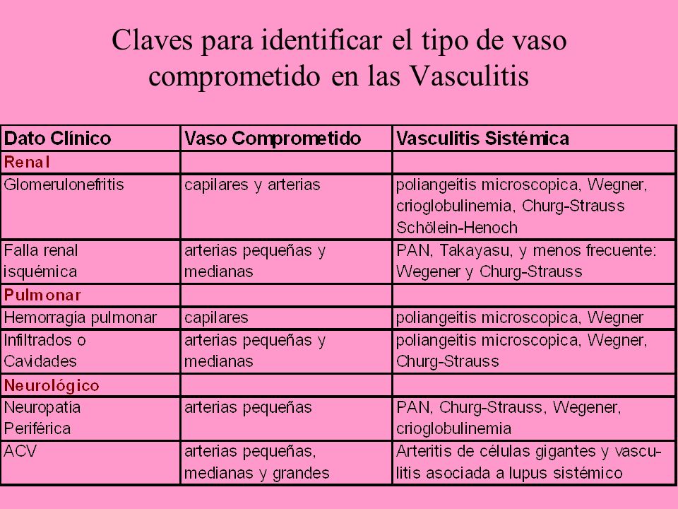 Claves para identificar el tipo de vaso comprometido en las Vasculitis