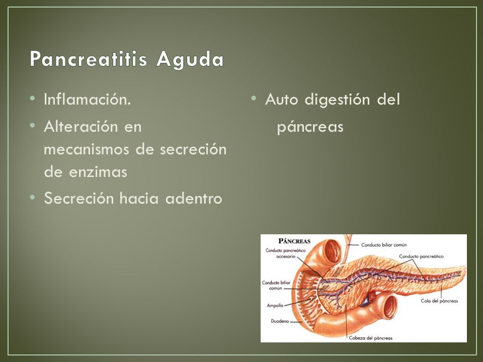 Pancreatitis Aguda Inflamación.