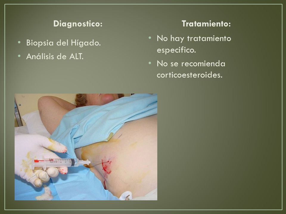 Diagnostico: Tratamiento: No hay tratamiento especifico. No se recomienda corticoesteroides. Biopsia del Hígado.
