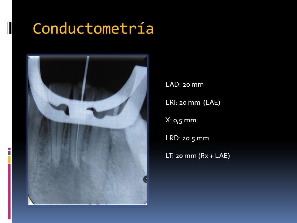 Conductometría LAD: 20 mm LRI: 20 mm (LAE) X: 0,5 mm LRD: 20.5 mm